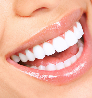 Smile Design